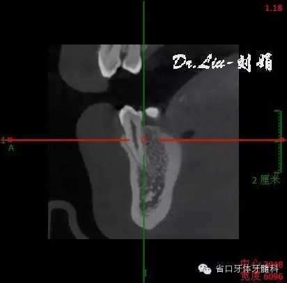 3.webp.jpg 3.webp.jpg