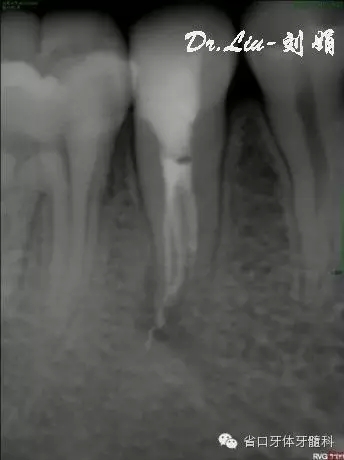 11.webp.jpg 11.webp.jpg