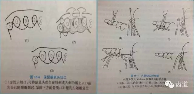 14.webp.jpg 14.webp.jpg