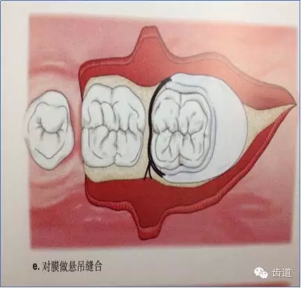 15.webp.jpg 15.webp.jpg