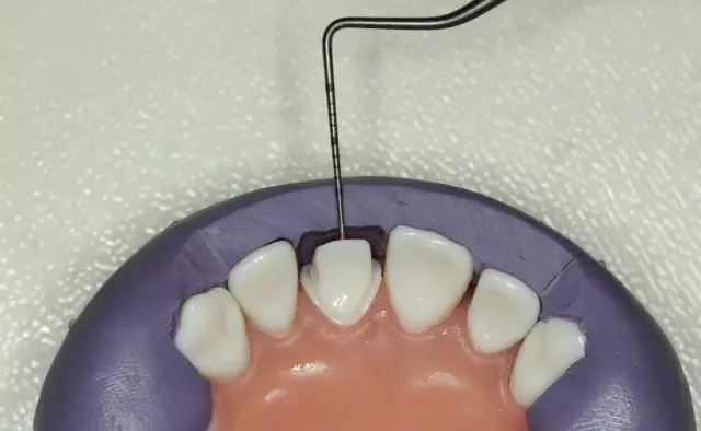 15.webp.jpg 15.webp.jpg