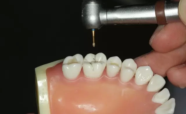 22.webp.jpg 22.webp.jpg