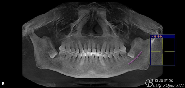 20141021204020_52569.jpg 20141021204020_52569.jpg