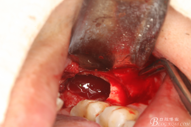 20141021204439_49240.jpg 20141021204439_49240.jpg