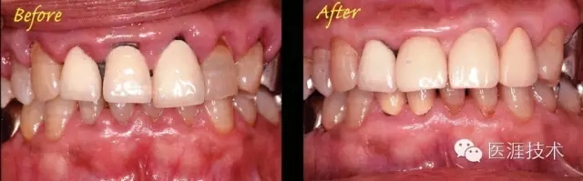 44.webp.jpg 44.webp.jpg