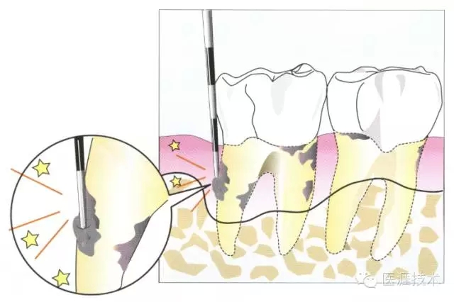 5.webp.jpg 5.webp.jpg