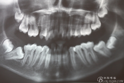 3_副本.jpg 3_副本.jpg