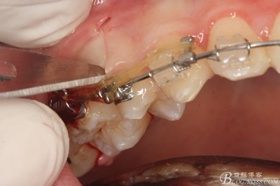 10_副本.jpg 10_副本.jpg