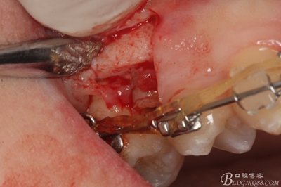 11_副本.jpg 11_副本.jpg