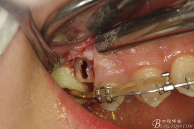 13_副本.jpg 13_副本.jpg