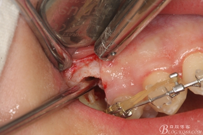 14_副本.jpg 14_副本.jpg