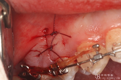 22_副本.jpg 22_副本.jpg