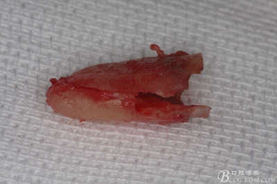 25_副本.jpg 25_副本.jpg