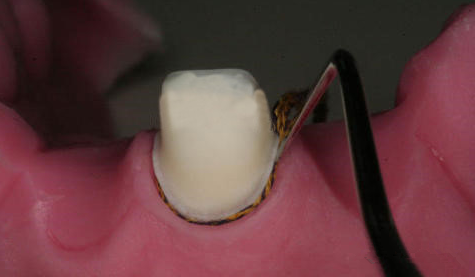 640 (1).png 640 (1).png