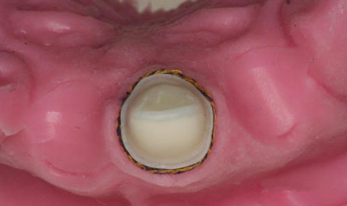 640 (3).png 640 (3).png