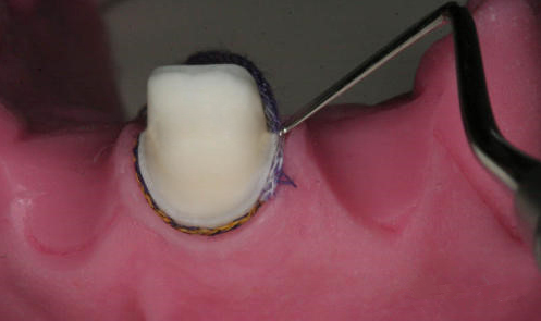 640 (4).png 640 (4).png