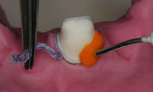 640 (7).png 640 (7).png