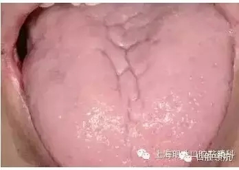 11.webp.jpg 11.webp.jpg