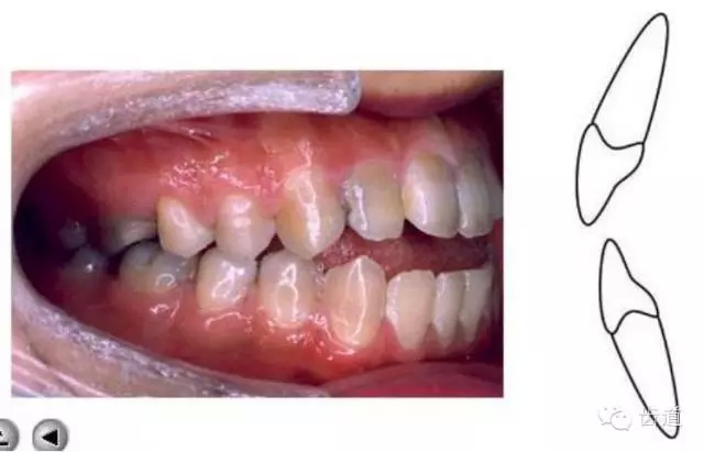 17.webp.jpg 17.webp.jpg