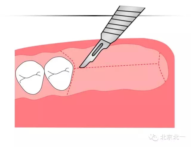 1.webp.jpg 1.webp.jpg