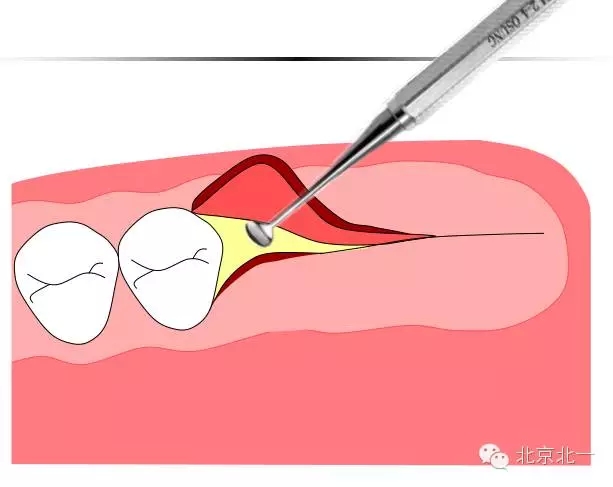 2.webp.jpg 2.webp.jpg