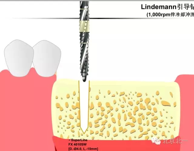 4.webp.jpg 4.webp.jpg