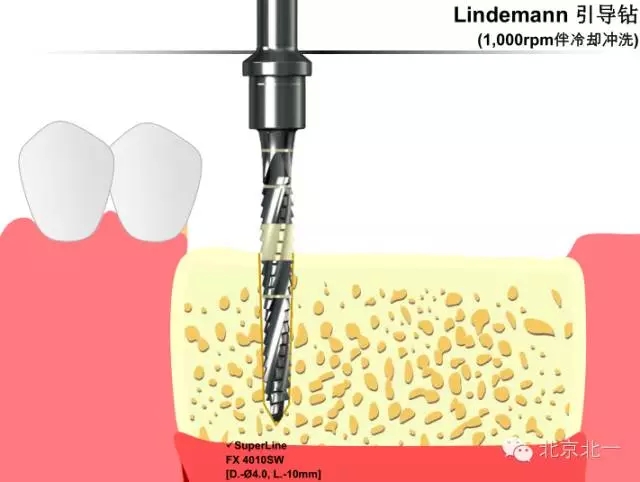 5.webp.jpg 5.webp.jpg