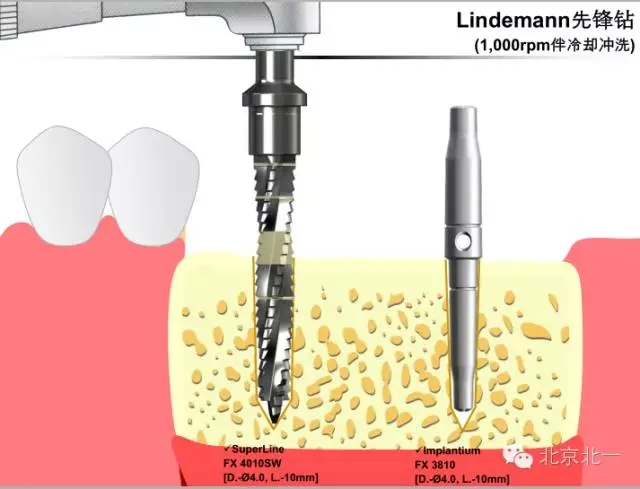 10.webp.jpg 10.webp.jpg