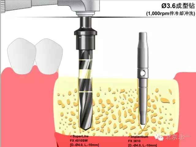 12.webp.jpg 12.webp.jpg