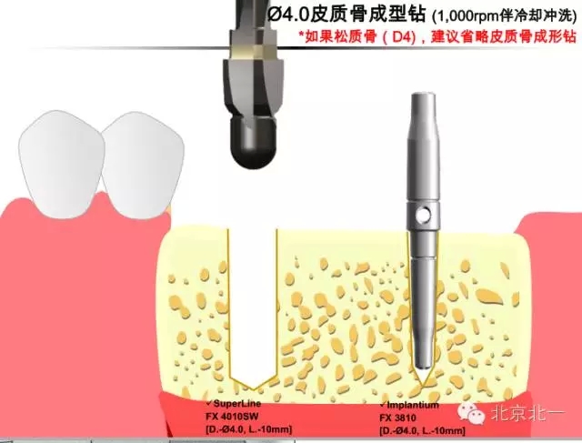 14.webp.jpg 14.webp.jpg