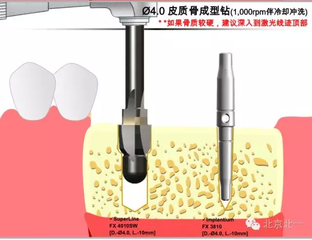 15.webp.jpg 15.webp.jpg