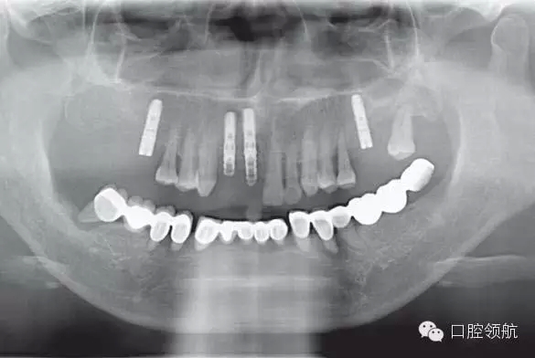 2.webp.jpg 2.webp.jpg