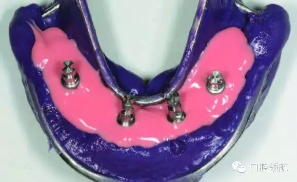 6.webp.jpg 6.webp.jpg