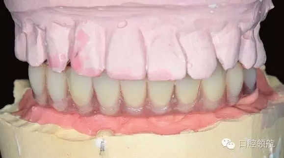 7.webp.jpg 7.webp.jpg