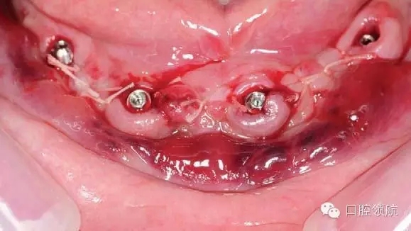 9.webp.jpg 9.webp.jpg