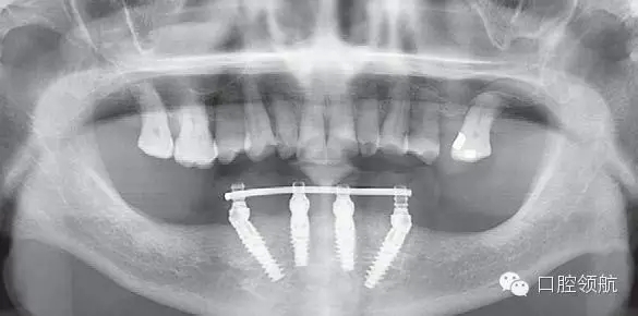 10.webp.jpg 10.webp.jpg