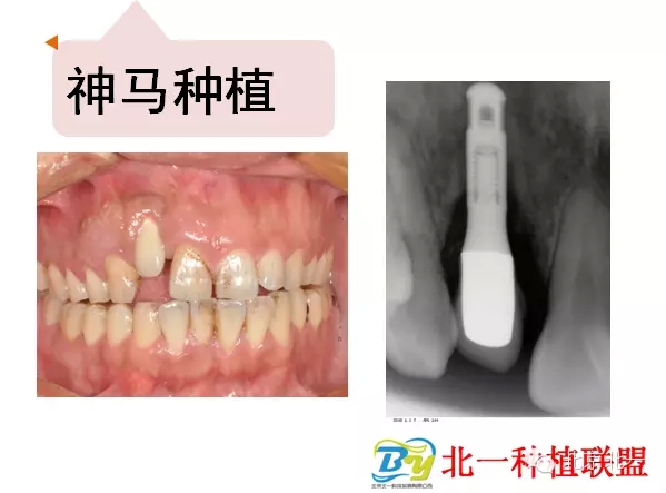 2.webp.jpg 2.webp.jpg