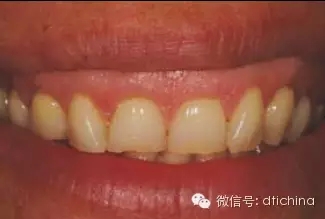 1.webp.jpg 1.webp.jpg