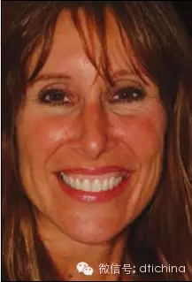 3.webp.jpg 3.webp.jpg