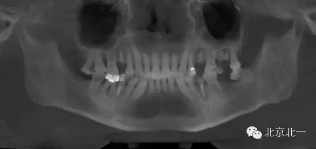 1.webp.jpg 1.webp.jpg