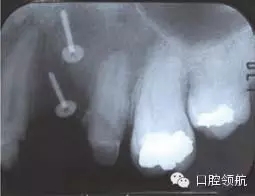 9.webp.jpg 9.webp.jpg