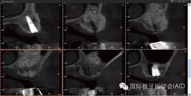 2.webp.jpg 2.webp.jpg