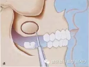 3.webp.jpg 3.webp.jpg