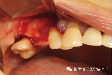 6.webp.jpg 6.webp.jpg