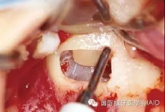 10.webp.jpg 10.webp.jpg