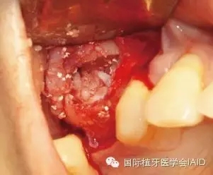 12.webp.jpg 12.webp.jpg