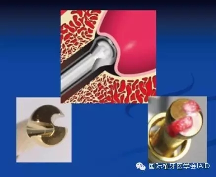 1.webp.jpg 1.webp.jpg