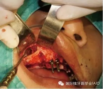 3.webp.jpg 3.webp.jpg