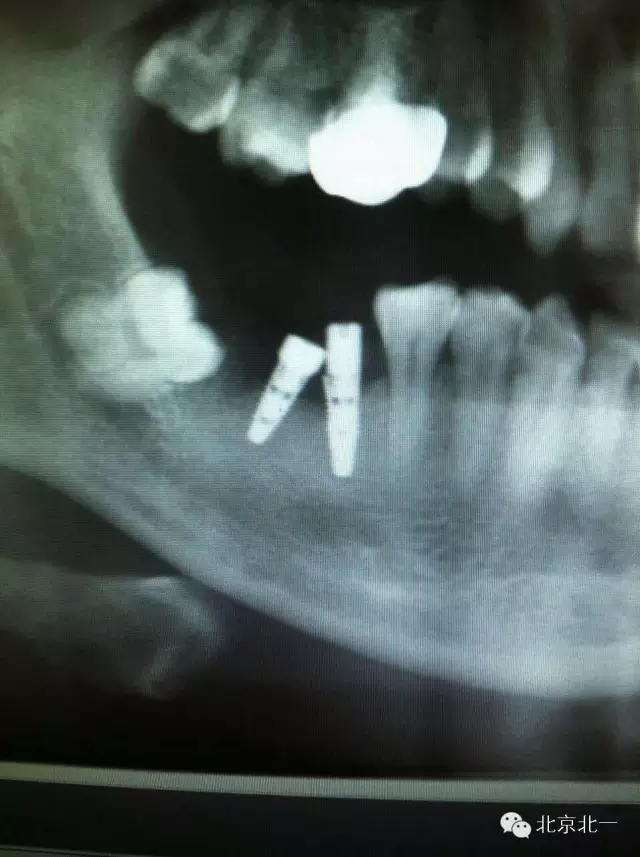 640.webp.jpg 640.webp.jpg