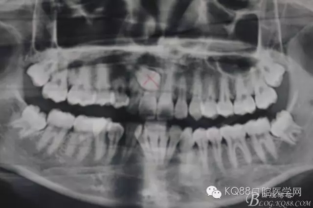 640.webp.jpg 640.webp.jpg